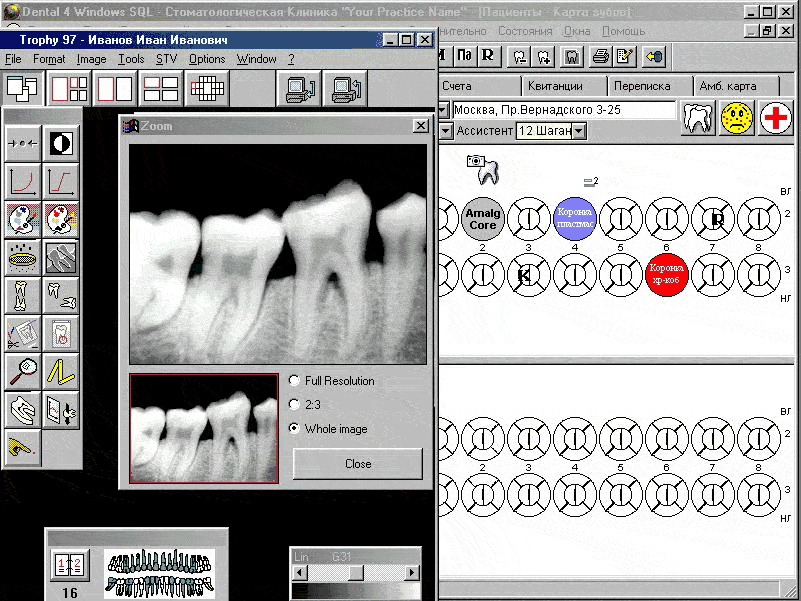 Дента 1 программа. Dental4windows программа для стоматологии. Программа для стоматологии Дентал 4. Программа Дентал 4 виндовс. Стоматологические программы для компьютера.